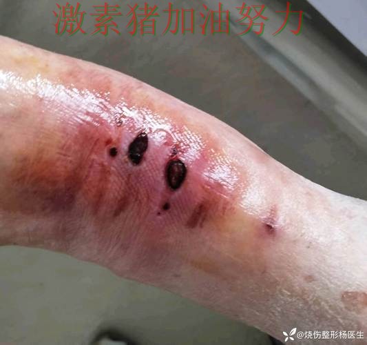 公牛防线告急球队隐患再次暴露 公牛防线告急球队隐患再次暴露